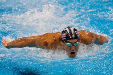 Cupping in Jewish Life and Law